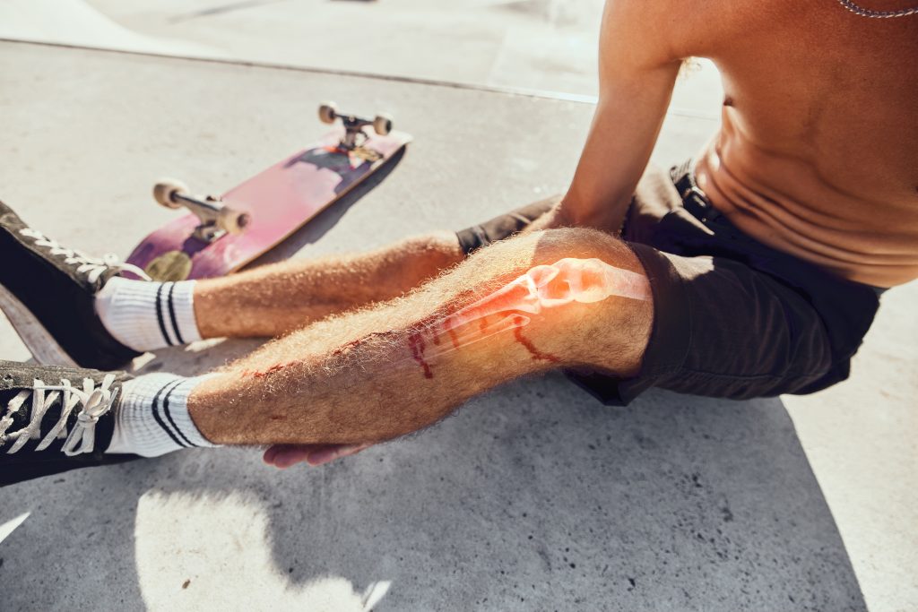 Bone Fracture Treatment In Thane