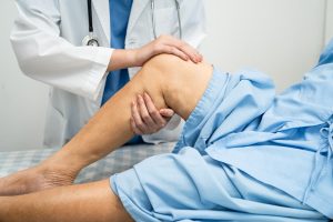 Knee Stiffness in the Morning: Is It a Sign of Arthritis?